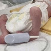Murió la bebé rescatada por cesárea del vientre de su madre fallecida tras ataque en Gaza